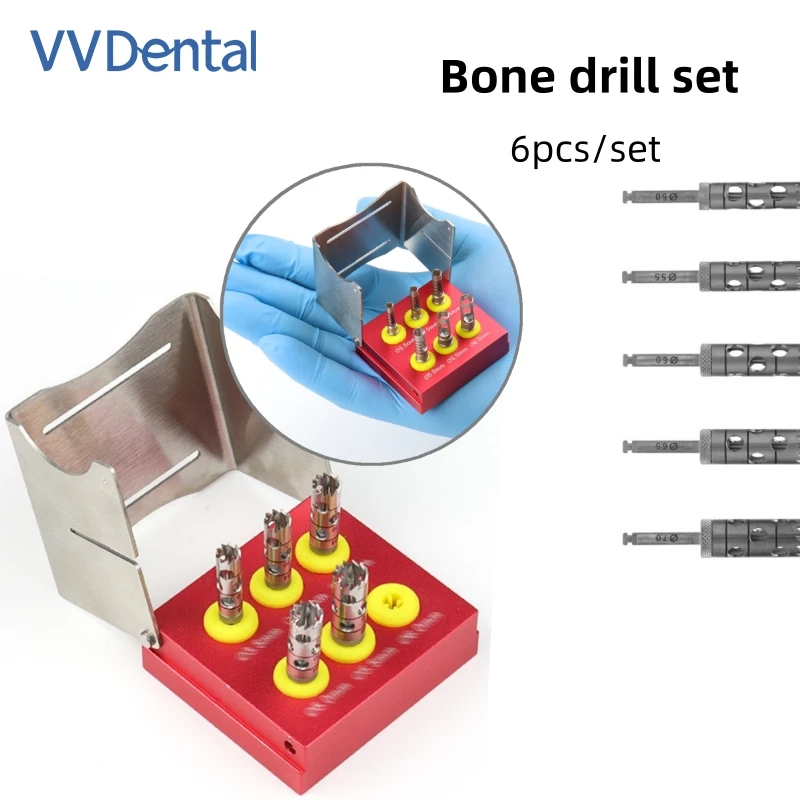 VV Dental 5/6pcs Dental Implant Bone Trephine With Bur Disinfection Holder Stainless Steel Dentists Instrument Accessories
VV Dental 5/6pcs Dental Implant Bone Trephine With Bur Disinfection Holder Stainless Steel Dentists Instrument Accessories