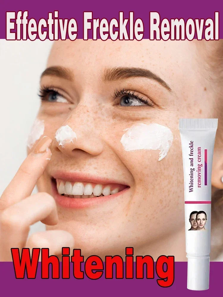 Effective Whitening Freckle Cream Remove Melasma Cream Remove Dark Spots Melanin Moisturize Brighten Smooth Face Skin Care
Effective Whitening Freckle Cream Remove Melasma Cream Remove Dark Spots Melanin Moisturize Brighten Smooth Face Skin Care