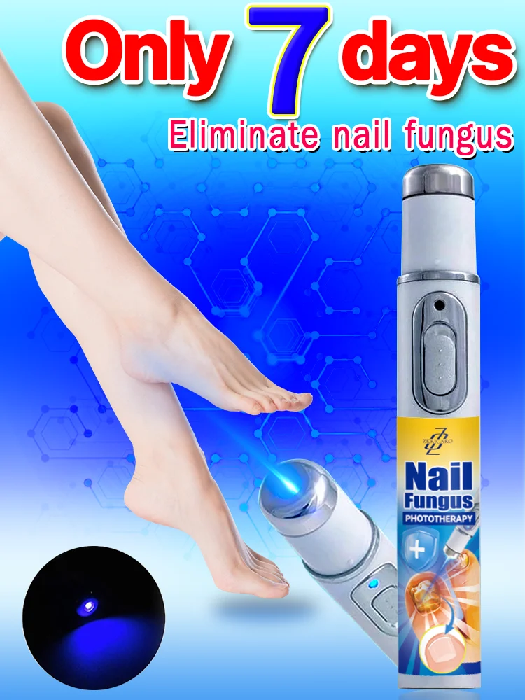 Nail fungus repair treatment, Completely clear athlete's foot, mold, odor, moisture, and itching with a laser pen for foot nails
Nail fungus repair treatment, Completely clear athlete's foot, mold, odor, moisture, and itching with a laser pen for foot nails