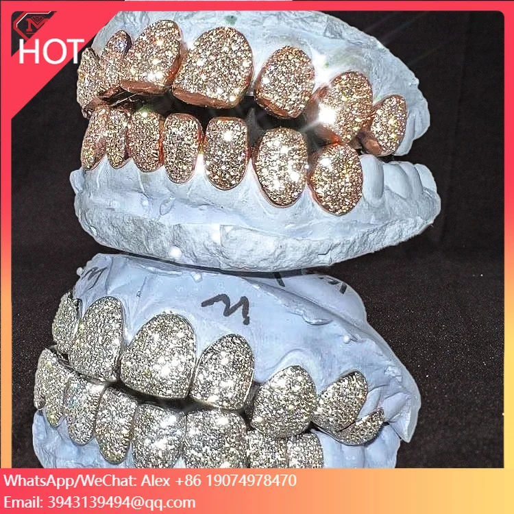 Набор зубных гриллей (8 верхних и 8 нижних) в стиле хип-хоп, с перманентной гравировкой, покрытие из розового золота, индивидуальный дизайн
Набор зубных гриллей (8 верхних и 8 нижних) в стиле хип-хоп, с перманентной гравировкой, покрытие из розового золота, индивидуальный дизайн