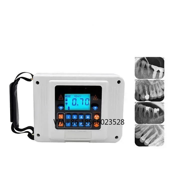 Portable X Ray Machine For Hospital Medical Supplies Medical Device Sensor Wireless Digital
Portable X Ray Machine For Hospital Medical Supplies Medical Device Sensor Wireless Digital