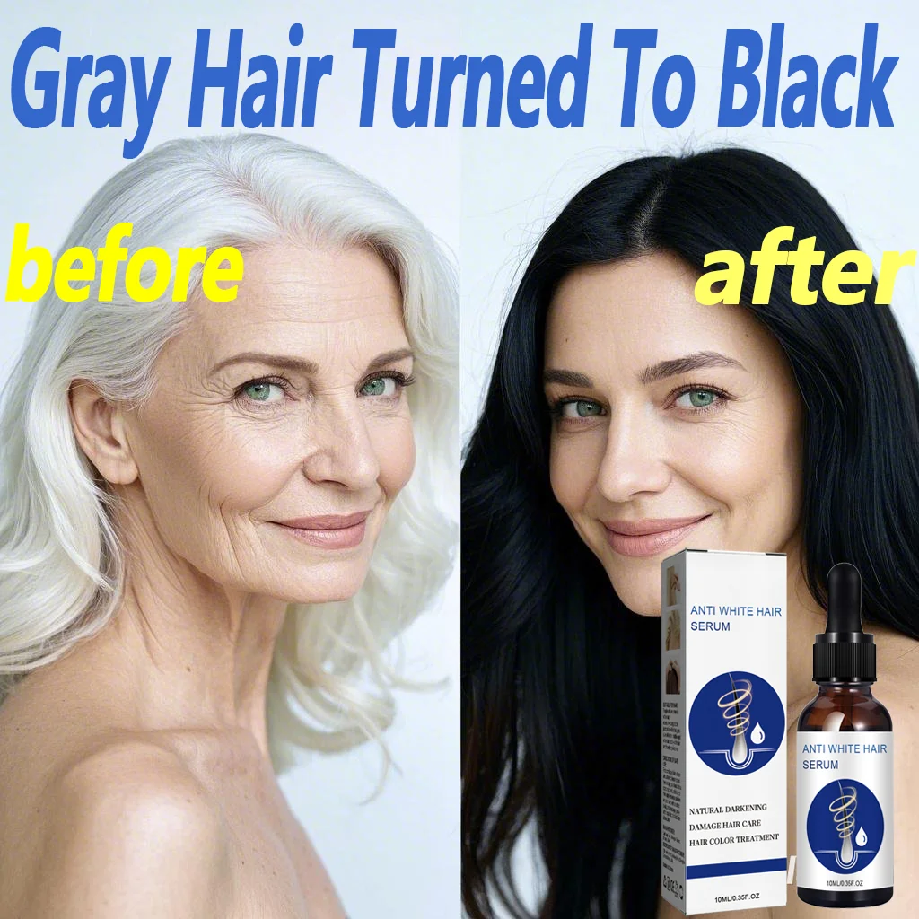 Anti white hair Essential Oil bringing back the natural black color delay the onset of white or gray hair Enhances Hair Shine
Anti white hair Essential Oil bringing back the natural black color delay the onset of white or gray hair Enhances Hair Shine