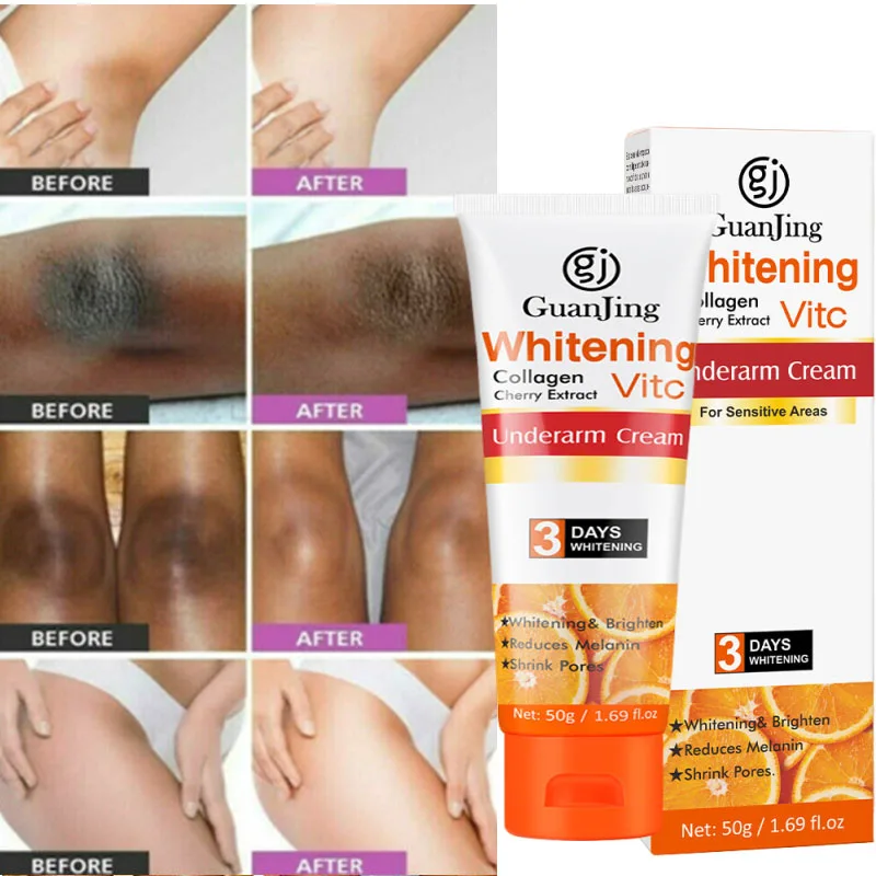 Body Whitening Cream Skin Private Parts Underarm Bleaching Cream Butt Knee Brighten Inner Thigh Remove Dark Melanin Whiten Care
Body Whitening Cream Skin Private Parts Underarm Bleaching Cream Butt Knee Brighten Inner Thigh Remove Dark Melanin Whiten Care