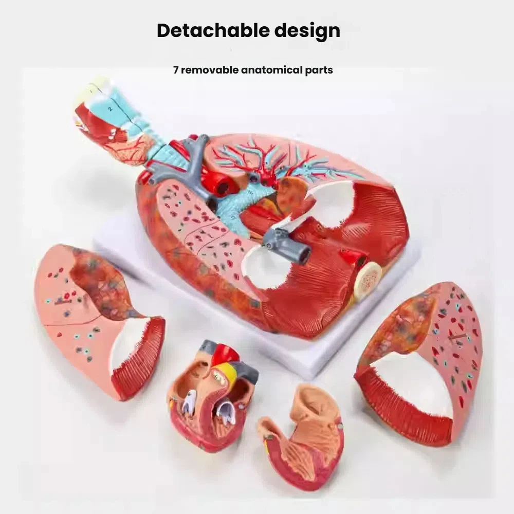 Human Medical Chest/Throat Anatomy Larynx Heart Lung Anatomical Model with 51 Signs 1:1 Respiratory System Teaching Supplies
Human Medical Chest/Throat Anatomy Larynx Heart Lung Anatomical Model with 51 Signs 1:1 Respiratory System Teaching Supplies