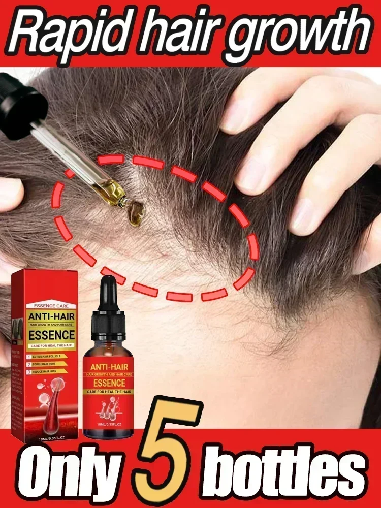 Hair Growth Essential Loss Regrowth Treatment Strengthens Hair Nourishes Scalp Light Weight Non Greasy Improve Scalp Circulation
Hair Growth Essential Loss Regrowth Treatment Strengthens Hair Nourishes Scalp Light Weight Non Greasy Improve Scalp Circulation