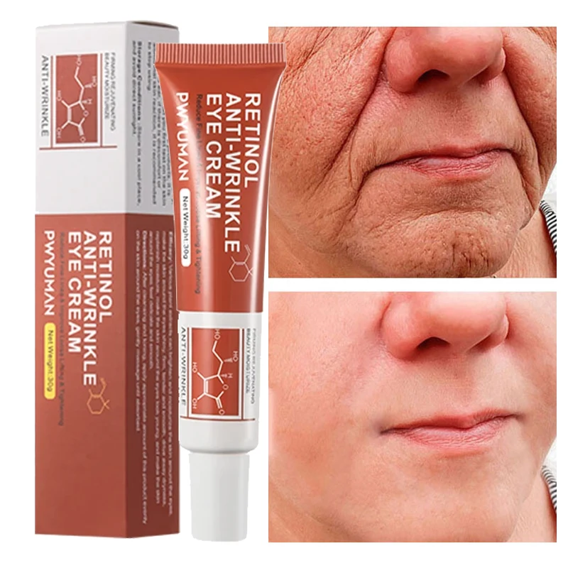 Instant Eye Bag Removal Cream Retinol Anti-Wrinkle Fade Fine Lines Anti Dark Circle Firming Skin Puffiness Brighten Eye Care
Instant Eye Bag Removal Cream Retinol Anti-Wrinkle Fade Fine Lines Anti Dark Circle Firming Skin Puffiness Brighten Eye Care