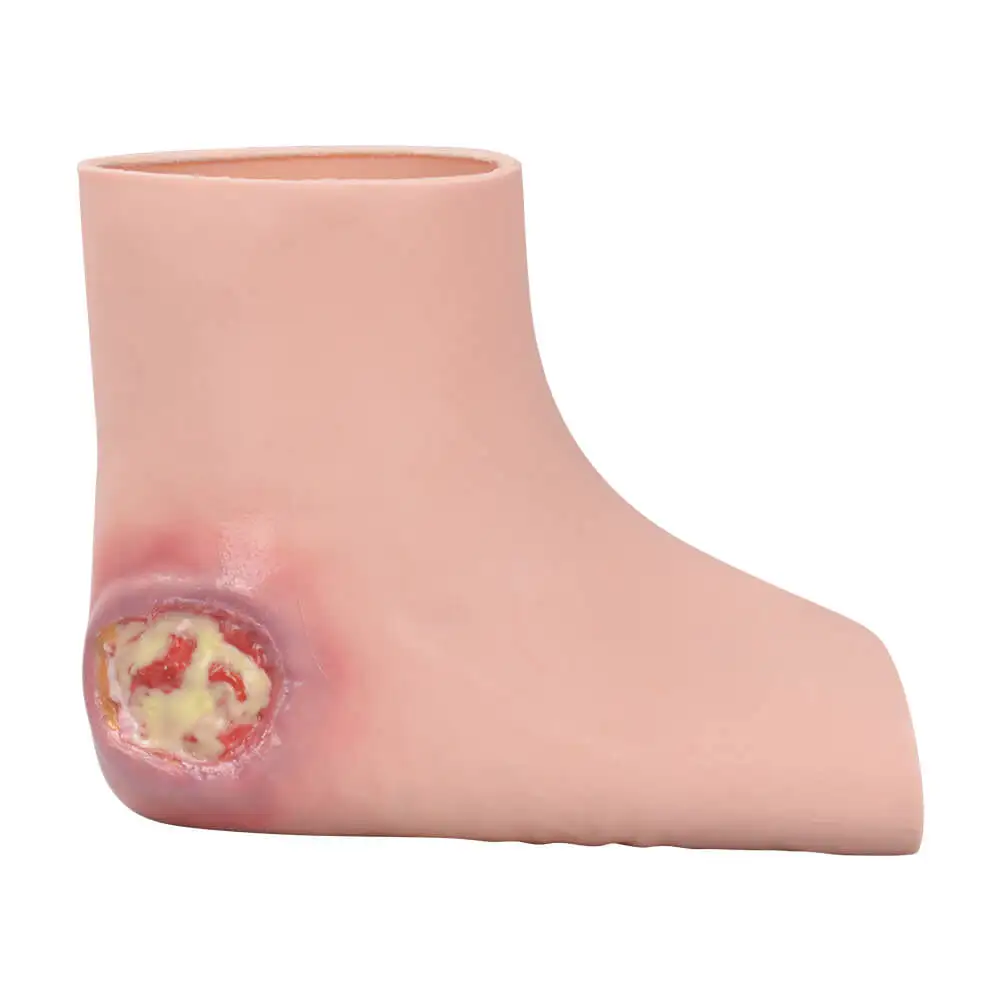 Ultrassist Heel Pressure Ulcer Nursing Training Model Wearable Silicone Foot Sleeve Educational Tool for Healthcare Professional
Ultrassist Heel Pressure Ulcer Nursing Training Model Wearable Silicone Foot Sleeve Educational Tool for Healthcare Professional