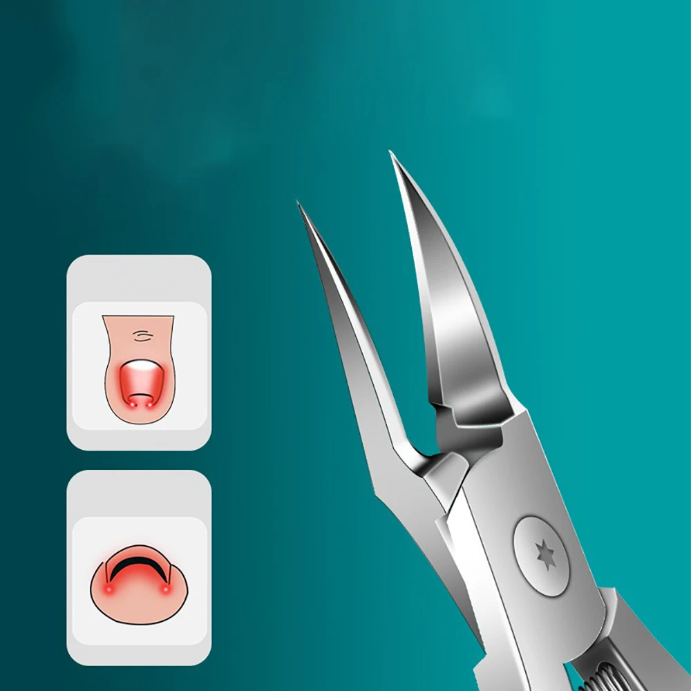 Специализированные кусачки для вросших ногтей, прочные кусачки для толстых ногтей, удобная рукоятка, противоскользящий дизайн, острая нержавеющая сталь.
Специализированные кусачки для вросших ногтей, прочные кусачки для толстых ногтей, удобная рукоятка, противоскользящий дизайн, острая нержавеющая сталь.