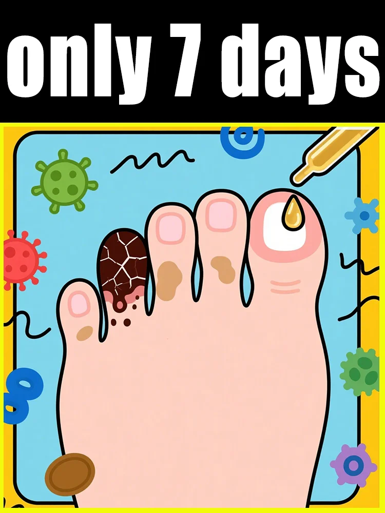 Quickly eliminate fungus and restore healthy nails 
Quickly eliminate fungus and restore healthy nails