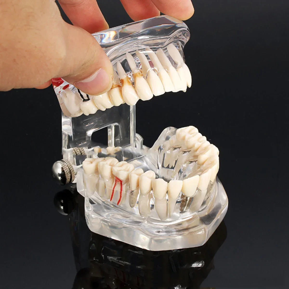 Dental Implant Model Teeth Model Tooth Dentist For Dental Disease Teaching Study Tool
Dental Implant Model Teeth Model Tooth Dentist For Dental Disease Teaching Study Tool