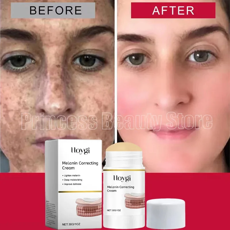 Powerful Spot-Removing Whiten Cream Brighten Skin Fast Eliminates Melanin Pigmentation Melasma Dark Spots Korean Skin Care
Powerful Spot-Removing Whiten Cream Brighten Skin Fast Eliminates Melanin Pigmentation Melasma Dark Spots Korean Skin Care