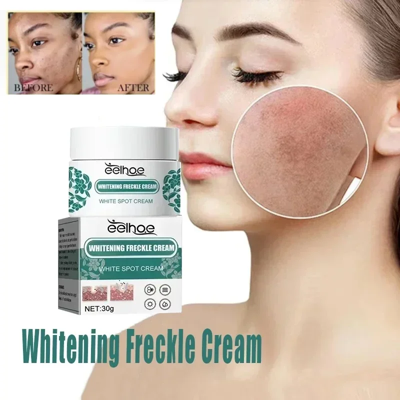 Niacinamide мелазма Осветляющий Крем Осветляющий Темный уменьшающий меланин Осветляющий крем для кожи хлоазма Сыворотка для ухода за лицом
Niacinamide мелазма Осветляющий Крем Осветляющий Темный уменьшающий меланин Осветляющий крем для кожи хлоазма Сыворотка для ухода за лицом