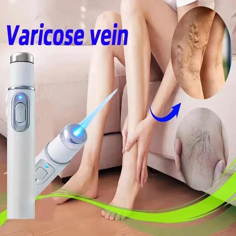 Varicose Vein Lampshade Therapy Effective Improved Blood Circulation Relief Of Dilated Vasculitis In The Legs Phlebitis
Varicose Vein Lampshade Therapy Effective Improved Blood Circulation Relief Of Dilated Vasculitis In The Legs Phlebitis