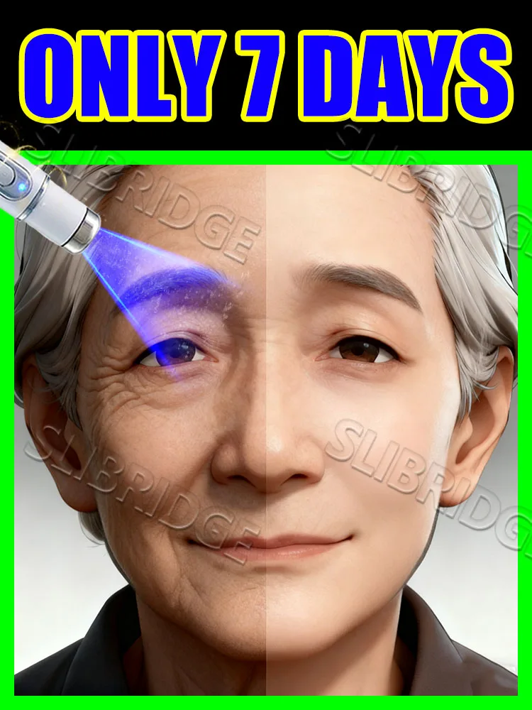 Soft focus filter, skin renewingskin care tools,blue light pen solve wrinkle Ease of use
Soft focus filter, skin renewingskin care tools,blue light pen solve wrinkle Ease of use