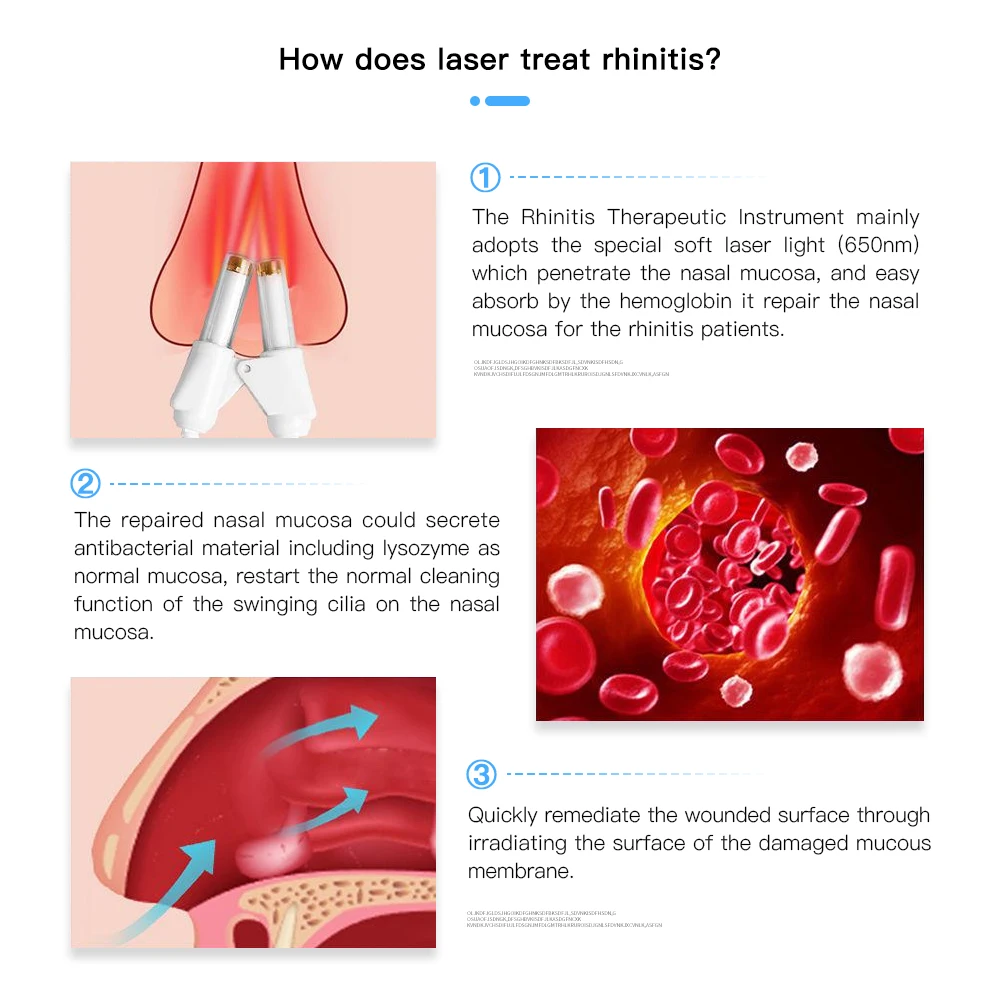 Nose Treatment Rhinitis Therapy Device SinusitisTreatment Nose Cure Massage Nasal Allergic Laser Light Therapy
Nose Treatment Rhinitis Therapy Device SinusitisTreatment Nose Cure Massage Nasal Allergic Laser Light Therapy