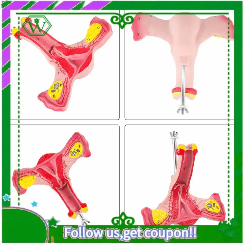 Reliable-1:1 Human Female Uterus Ovary Fallopian Tubes Model Anatomical Human Anatomy Model Teaching Tools
Reliable-1:1 Human Female Uterus Ovary Fallopian Tubes Model Anatomical Human Anatomy Model Teaching Tools