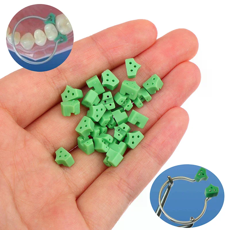 40Pcs Rubber Silicone Dental Add-On Wedges For Teeth Filling Use Sectional Contoured Dentistry Restoration Materials
40Pcs Rubber Silicone Dental Add-On Wedges For Teeth Filling Use Sectional Contoured Dentistry Restoration Materials