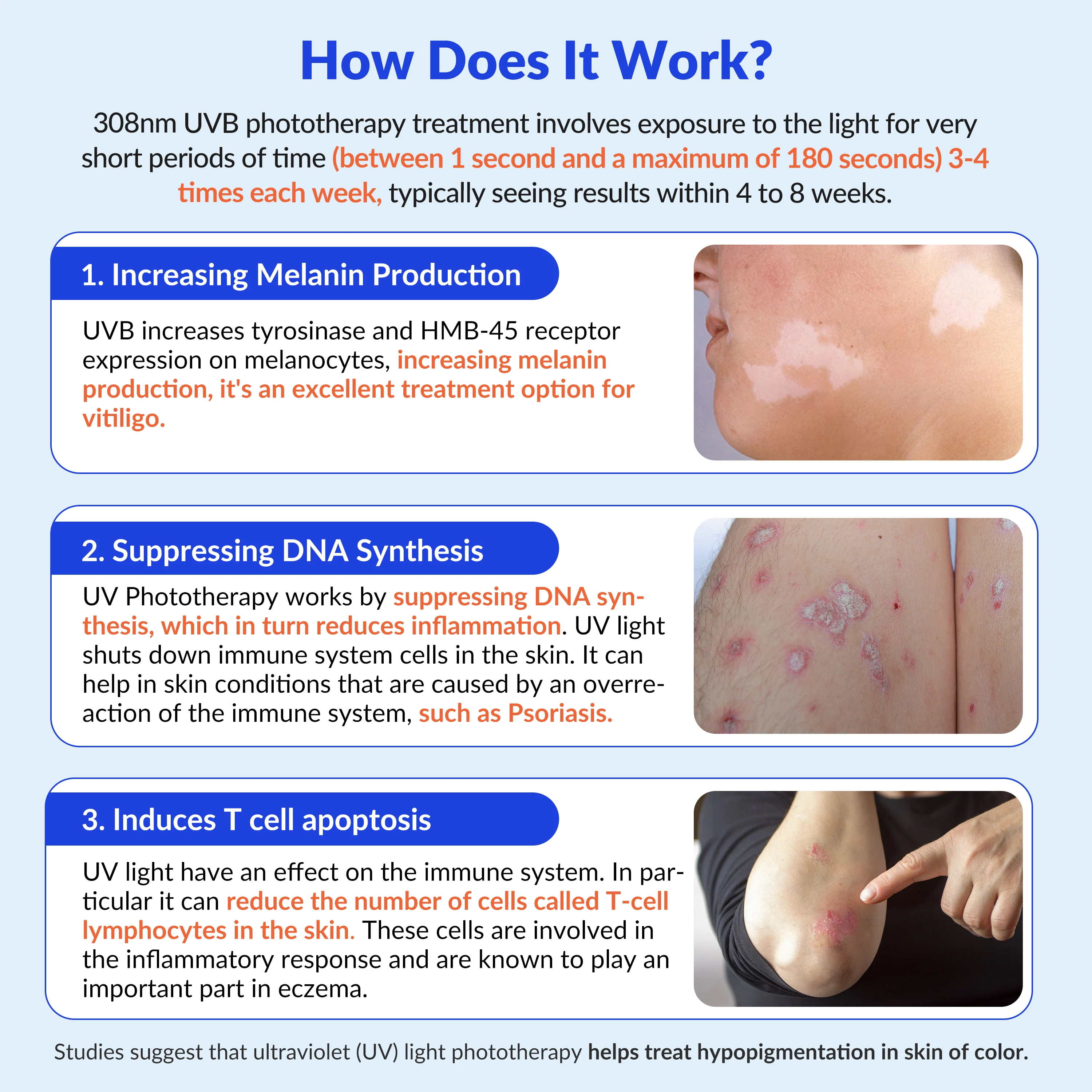 NEW 2026 Medical Grade 308nm Excimer UV Light Therapy Lamp for Vitiligo Psoriasis and Eczema Skin Care
NEW 2026 Medical Grade 308nm Excimer UV Light Therapy Lamp for Vitiligo Psoriasis and Eczema Skin Care