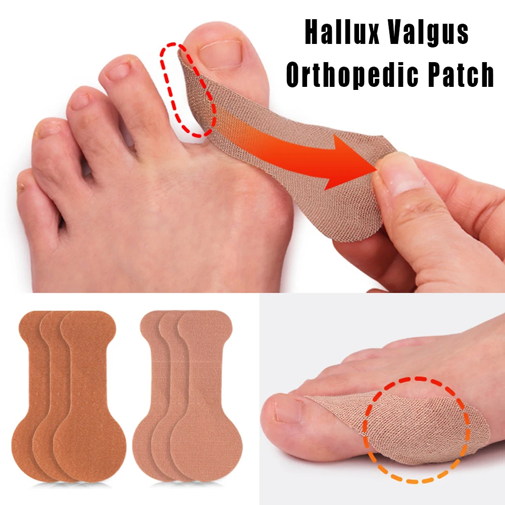 10/50 шт. ортодонтический пластырь Hallux Valgus, противоизносная корректирующая подушечка для большого пальца ноги, спортивный защитный пластырь для фиксации суставов
10/50 шт. ортодонтический пластырь Hallux Valgus, противоизносная корректирующая подушечка для большого пальца ноги, спортивный защитный пластырь для фиксации суставов