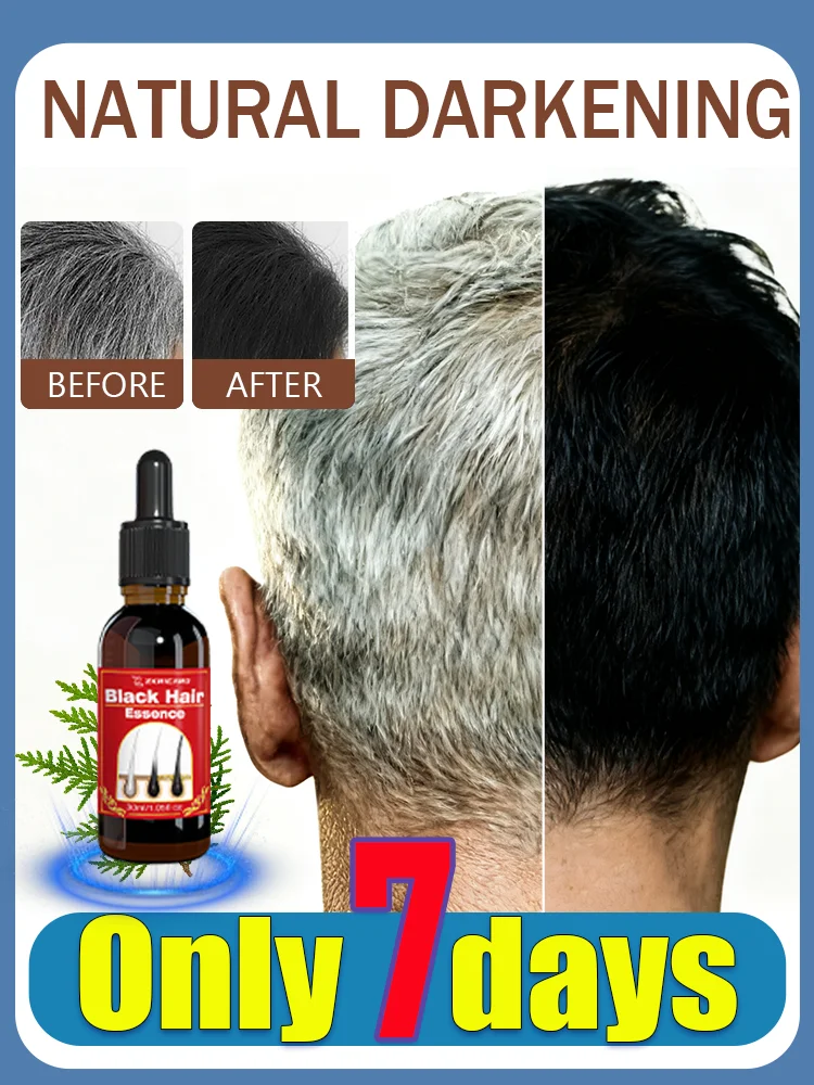 Wʜɪᴛᴇ ᴛᴏ ʙʟᴀᴄᴋ ɢʀᴀʏ ʜᴀɪʀ ᴇssᴇɴᴄᴇ ɴᴀᴛᴜʀᴀʟ ᴄᴏʟᴏʀ ʀᴇᴘᴀɪʀ ɴᴏᴜʀɪsʜɪɴɢ ᴇssᴇɴᴄᴇ ᴀɴᴛɪ-ɢʀᴀʏ ᴄᴀʀᴇ sᴜɪᴛᴀʙʟᴇ ғᴏʀ ᴍᴇɴ ᴀɴᴅ ᴡᴏᴍᴇɴ
Wʜɪᴛᴇ ᴛᴏ ʙʟᴀᴄᴋ ɢʀᴀʏ ʜᴀɪʀ ᴇssᴇɴᴄᴇ ɴᴀᴛᴜʀᴀʟ ᴄᴏʟᴏʀ ʀᴇᴘᴀɪʀ ɴᴏᴜʀɪsʜɪɴɢ ᴇssᴇɴᴄᴇ ᴀɴᴛɪ-ɢʀᴀʏ ᴄᴀʀᴇ sᴜɪᴛᴀʙʟᴇ ғᴏʀ ᴍᴇɴ ᴀɴᴅ ᴡᴏᴍᴇɴ