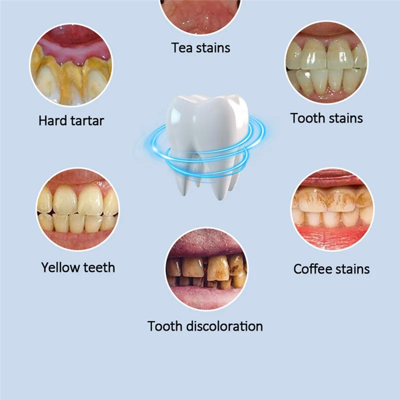 ASWUT-полировщик зубов, аккумуляторная полировщик зубов с 6 насадками-щеткой, набор для отбеливания зубов для чистки и полировки
ASWUT-полировщик зубов, аккумуляторная полировщик зубов с 6 насадками-щеткой, набор для отбеливания зубов для чистки и полировки