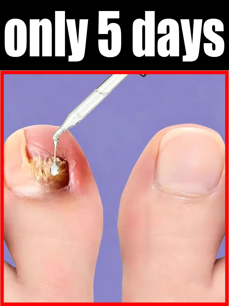 Gentle penetration , restore natural radiance
Gentle penetration , restore natural radiance