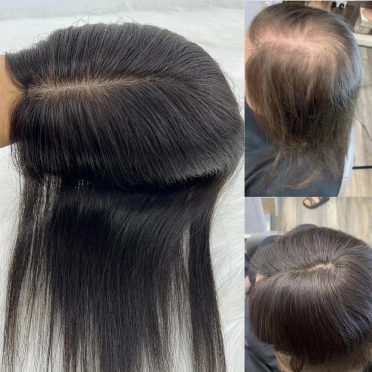 180% Density Human Hair Topper for Women Silk Skin Base Toupee with Clips in Natural Scalp Pre Plucked Thick Hair High Density
180% Density Human Hair Topper for Women Silk Skin Base Toupee with Clips in Natural Scalp Pre Plucked Thick Hair High Density