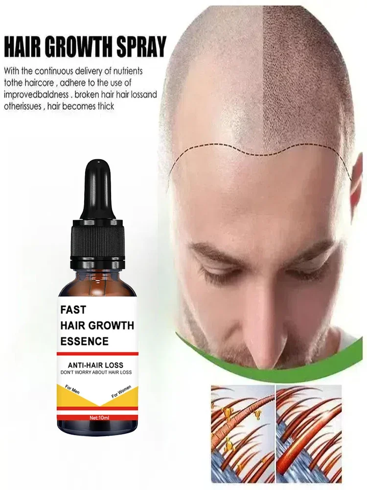 Your own hair is still the best, say goodbye to baldness, it’s real and effective!
Your own hair is still the best, say goodbye to baldness, it’s real and effective!