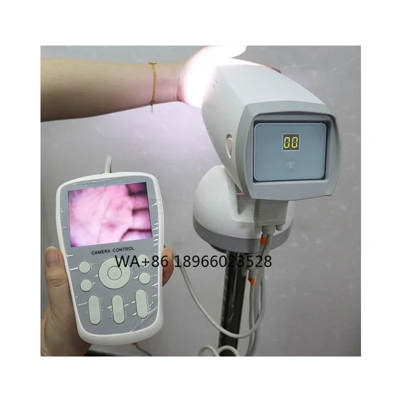 SY-F005 Handheld Electronic Colposcopy Effective Electronic Colposcopy for Cervical Cancer Checking and Woman Health
SY-F005 Handheld Electronic Colposcopy Effective Electronic Colposcopy for Cervical Cancer Checking and Woman Health
