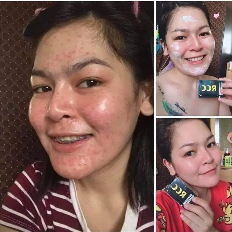 Repairing Whitening Night Cream 20g Reduce Melasmas Anti-Wrinkle Acne-treatment Moisturizing Whitening Smoothing Face Skin Care
Repairing Whitening Night Cream 20g Reduce Melasmas Anti-Wrinkle Acne-treatment Moisturizing Whitening Smoothing Face Skin Care