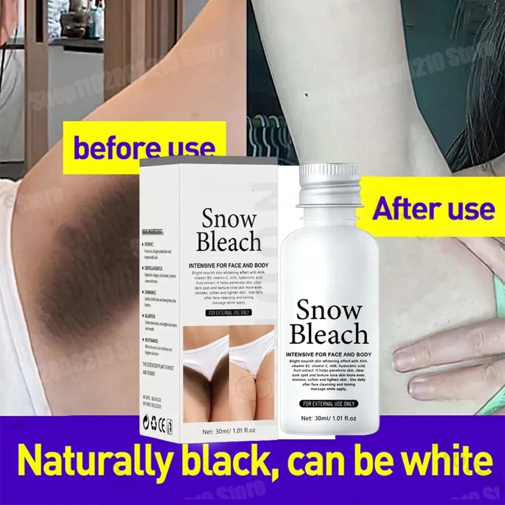 Effective whitening cream underarm whitening cream for dark areas pampaputi sa kilikili singit whitening bleaching cream
Effective whitening cream underarm whitening cream for dark areas pampaputi sa kilikili singit whitening bleaching cream