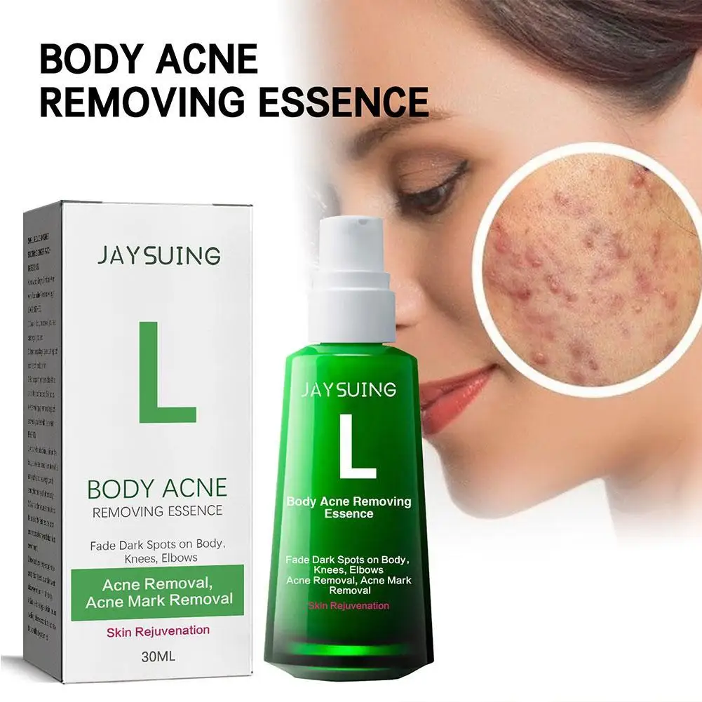 New Acne Remover Face Serum Herbs Acne Treatment Pimple Remover Shrink Pores Oil Control Face Herb Acne Skin Care 30ml
New Acne Remover Face Serum Herbs Acne Treatment Pimple Remover Shrink Pores Oil Control Face Herb Acne Skin Care 30ml
