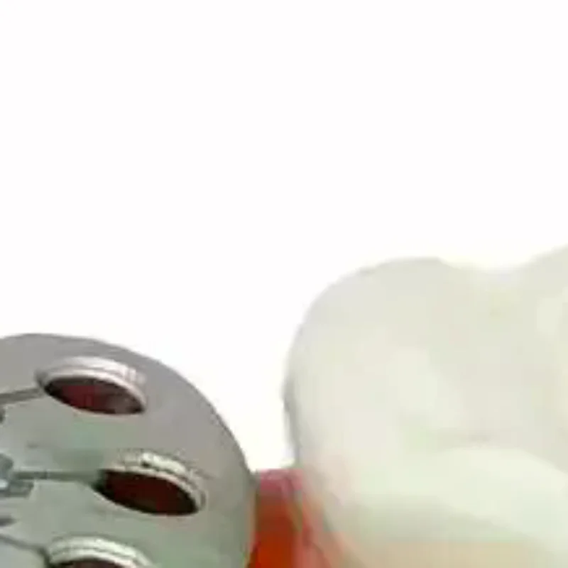 Зубной имплантат, параллельный штифтовый калибр, медицинский локатор из нержавеющей стали, руководство по установке зубного имплантата, линейка для поиска
Зубной имплантат, параллельный штифтовый калибр, медицинский локатор из нержавеющей стали, руководство по установке зубного имплантата, линейка для поиска