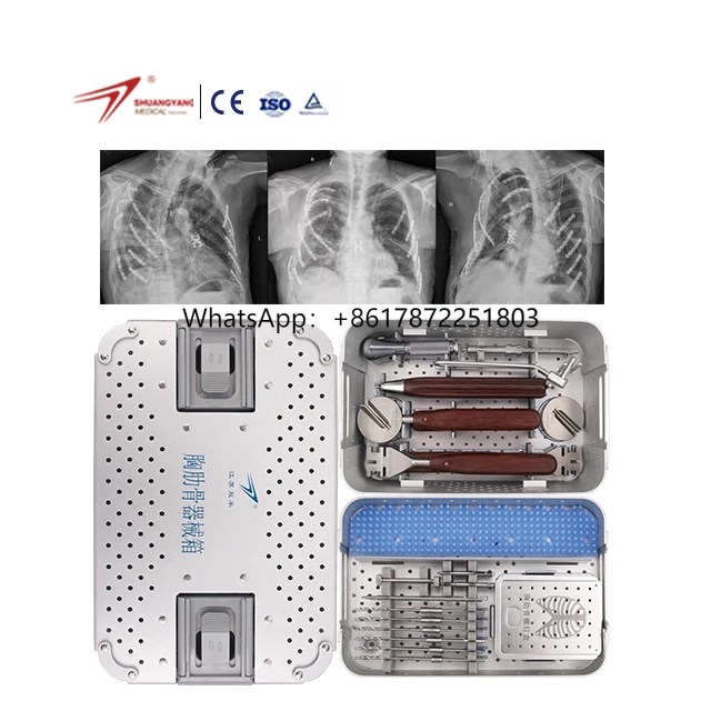 Shuangyang Factory Price Hot Sales Surgical Trauma Instrument Rib Plate Instrument Set Rib Plate Instrument Box Set
Shuangyang Factory Price Hot Sales Surgical Trauma Instrument Rib Plate Instrument Set Rib Plate Instrument Box Set
