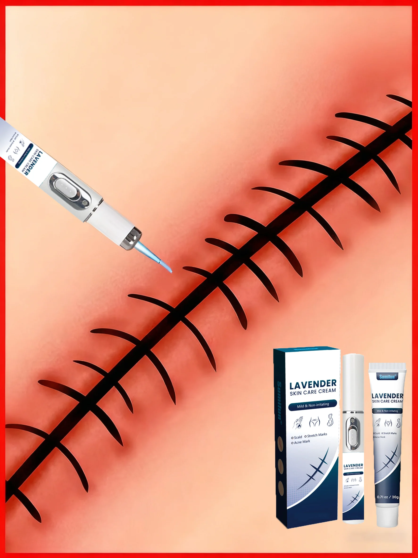 Effective Stretch Mark Repair: Laser Pen for Post-Pregnancy Care
Effective Stretch Mark Repair: Laser Pen for Post-Pregnancy Care