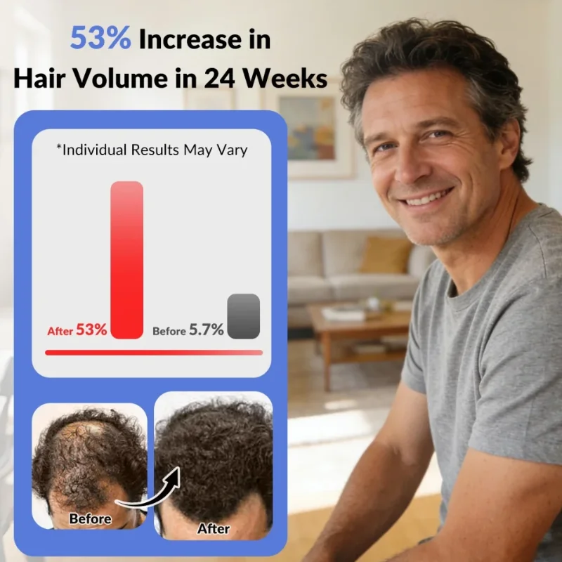 High Power Upgraded 6750mW LLLT Red Light Laser Hair Helmet 90 Diodes 210 LEDs for Scalp Nourishment Anti Hair Loss Regrowth
High Power Upgraded 6750mW LLLT Red Light Laser Hair Helmet 90 Diodes 210 LEDs for Scalp Nourishment Anti Hair Loss Regrowth
