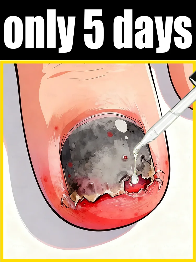 Say goodbye to uneven, yellow nails and cultivate smooth, shiny ones
Say goodbye to uneven, yellow nails and cultivate smooth, shiny ones