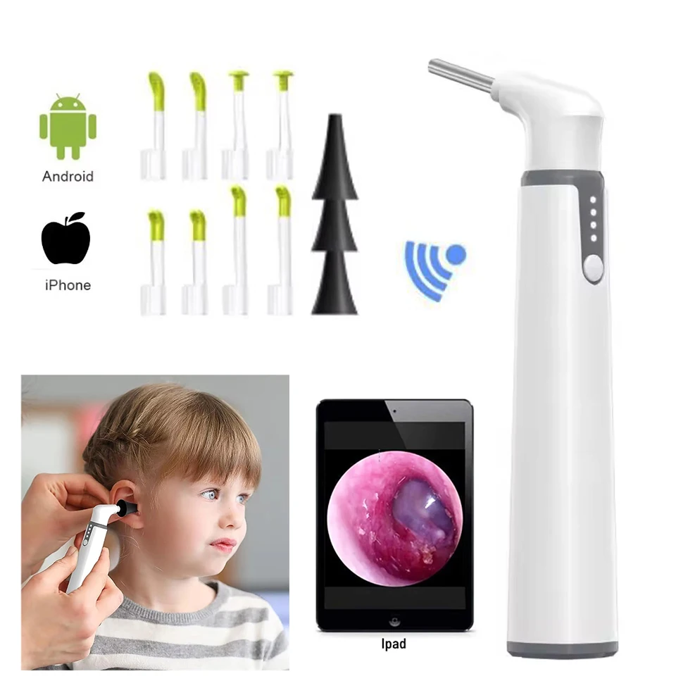 3.9mm Wireless Visual Digital Android iPhone Ear Wax Nose Cleaning Spoon Endoscope Camera 720P Wifi Scope for Kids Adults D2
3.9mm Wireless Visual Digital Android iPhone Ear Wax Nose Cleaning Spoon Endoscope Camera 720P Wifi Scope for Kids Adults D2