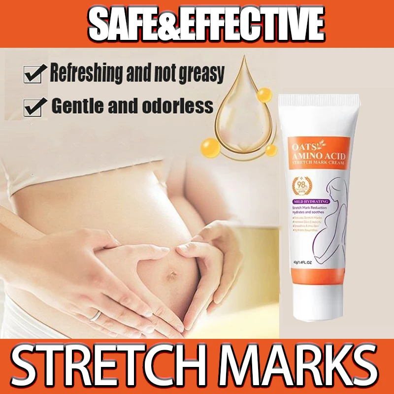 Remove Skin Cracks Repair Firming Care Stretch Marks Moisturize Cream Eliminate Body Belly Stretch Marks Removal Swelling Marks
Remove Skin Cracks Repair Firming Care Stretch Marks Moisturize Cream Eliminate Body Belly Stretch Marks Removal Swelling Marks