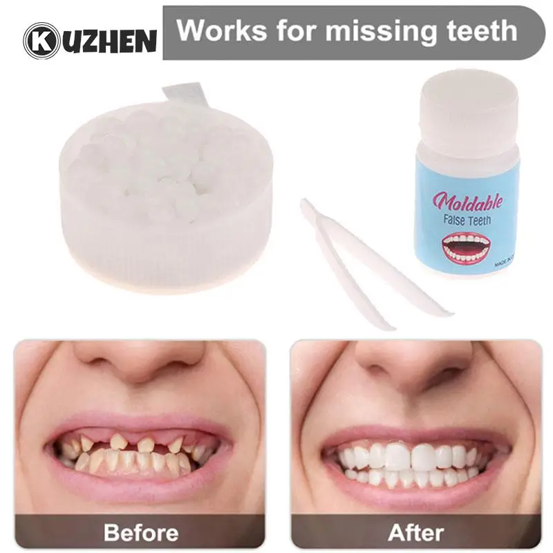 10/15/20g Temporary Tooth Repair Kit FalseTeeth Solid Glue Denture Adhesive Teeth And Gaps Whitening Beauty Tool
10/15/20g Temporary Tooth Repair Kit FalseTeeth Solid Glue Denture Adhesive Teeth And Gaps Whitening Beauty Tool