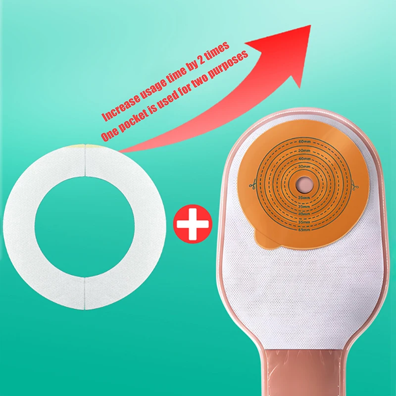 Ostomy Bag High Quality Medical Grade Skin Friendly Hypoallergenic Easy to Use Long Lasting Best Choice
Ostomy Bag High Quality Medical Grade Skin Friendly Hypoallergenic Easy to Use Long Lasting Best Choice