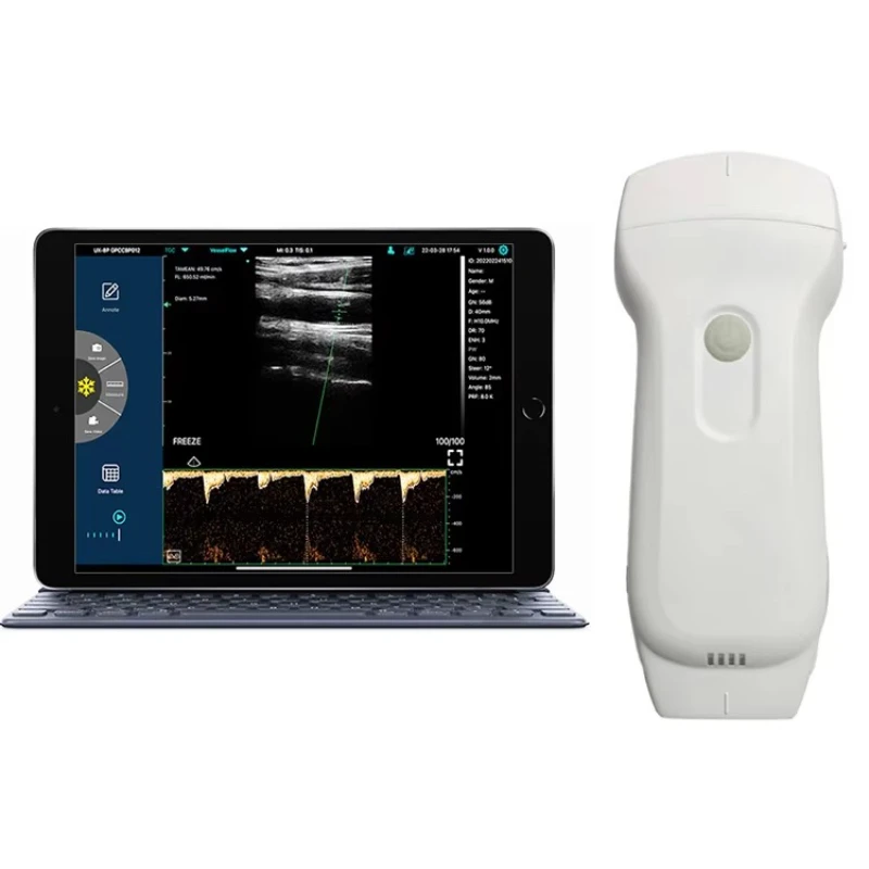 Portable Veterinary Ultrasound Equipment Cattle/Horse/Goat/Pig Pregnancy 4d Ultrasound Scanner Echo Motorized CE
Portable Veterinary Ultrasound Equipment Cattle/Horse/Goat/Pig Pregnancy 4d Ultrasound Scanner Echo Motorized CE