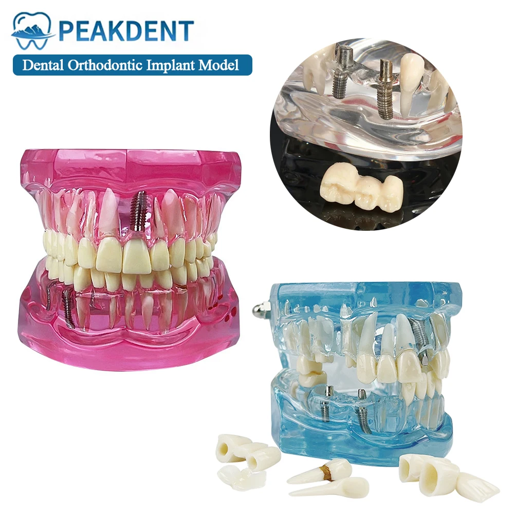 Модель для ремонта зубов, съемная модель зубов с патологиями для практики и обучения студентов-стоматологов, медицинская модель для изучения полости рта
Модель для ремонта зубов, съемная модель зубов с патологиями для практики и обучения студентов-стоматологов, медицинская модель для изучения полости рта