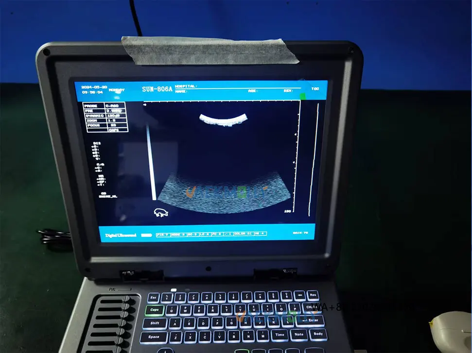 Equipment Accurate Detection for Animal Reproductive and Health Conditions Cheapest Veterinary B - Mode Ultrasound
Equipment Accurate Detection for Animal Reproductive and Health Conditions Cheapest Veterinary B - Mode Ultrasound