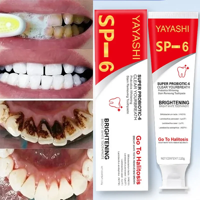 SP-6 Probiotic Toothpaste Whiten Tooth Remove Plaque Stains Oral Hygiene Clean Fresh Breath Protect Gum Teeth Care Products 2024
SP-6 Probiotic Toothpaste Whiten Tooth Remove Plaque Stains Oral Hygiene Clean Fresh Breath Protect Gum Teeth Care Products 2024