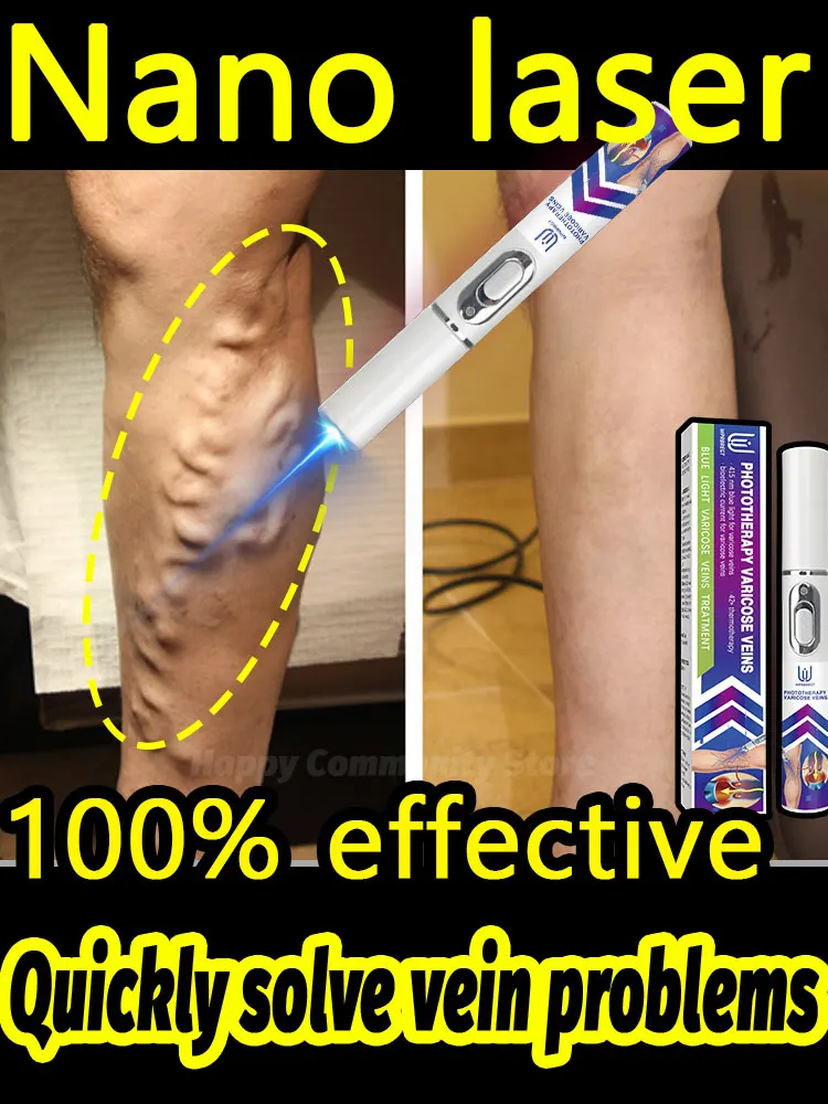 2025 Laser Varicose Vein Treatment, the Savior of Varicose Veins 
2025 Laser Varicose Vein Treatment, the Savior of Varicose Veins