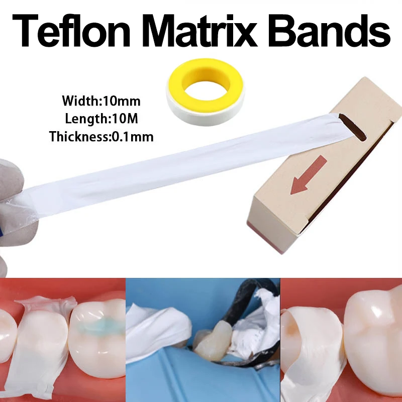 1Roll Dental Material Teflon Matrix Bands White Matrice Strips Anti Corrosive Thickness 0.1Mm Dentist Restore Material
1Roll Dental Material Teflon Matrix Bands White Matrice Strips Anti Corrosive Thickness 0.1Mm Dentist Restore Material