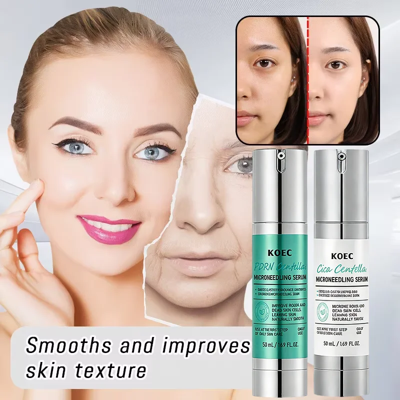 Korean Microneedle Essence Desalination Fine Lines Spots Collagen Solution Reverse Aging Recombinant Improves Rough Texture 50ml
Korean Microneedle Essence Desalination Fine Lines Spots Collagen Solution Reverse Aging Recombinant Improves Rough Texture 50ml