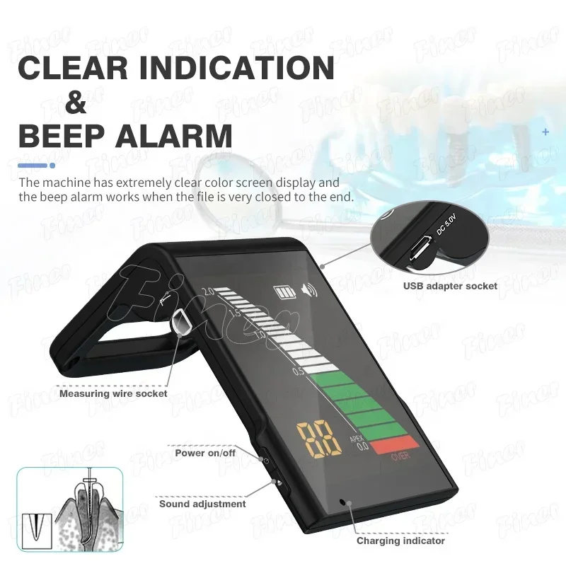 2025FINER apex locator mini apex locator for root canal treatment apex locator
2025FINER apex locator mini apex locator for root canal treatment apex locator