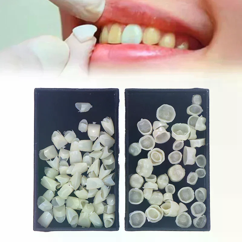 Стоматологическая временная зубная корона, задняя и задняя корона, фарфоровая корона, смоляные зубы, стоматологическая лаборатория, стоматологические принадлежности
Стоматологическая временная зубная корона, задняя и задняя корона, фарфоровая корона, смоляные зубы, стоматологическая лаборатория, стоматологические принадлежности